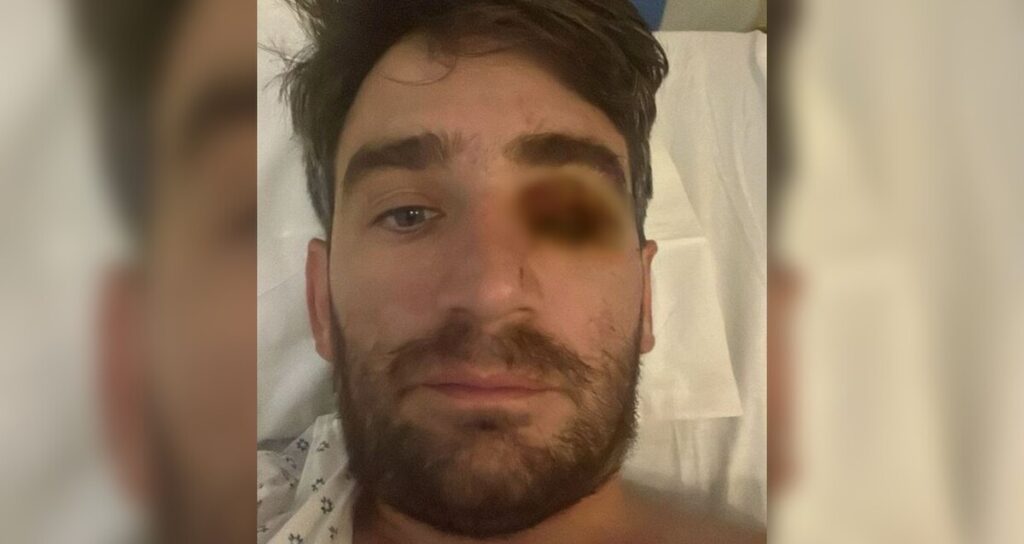 Hombre pierde un ojo por explosión de fuegos pirotécnicos en fiesta de Año Nuevo