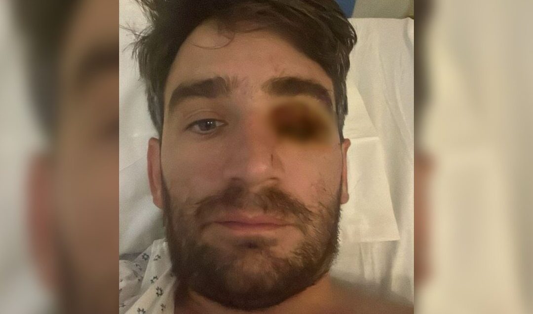 Hombre pierde un ojo por explosión de fuegos pirotécnicos en fiesta de Año Nuevo